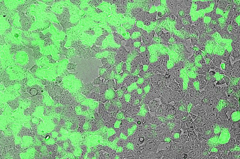 green lung cells model